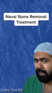 Doctor Reacts To Lost Baggage In Bellybutton