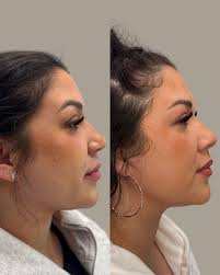 Rachel Codd DNP, AGACNP-BC (@rachelcodd.dnp) • Instagram photos and videos