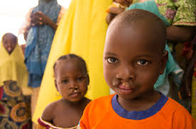 Spenden&Legate — Cleft-Kinder-Hilfe Schweiz