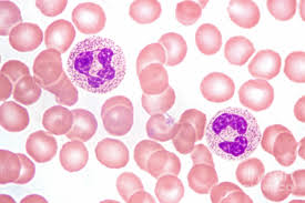 Image result for Peripheral Smear