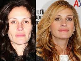 Julia Roberts Plastic Surgery Before And After Photos Celebrity Plastic Surgery Facial Plastic Plastic Surgery