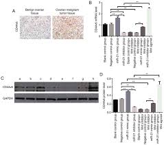 The color green represents gall bladder cancer, as well as liver cancer. Promotion Of Ovarian Cancer Cell Invasion Migration And Colony Formation By The Mir 21 Wnt Cd44v6 Pathway