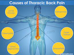 The most common cause of thoracic back pain is inflammation of the muscles or soft tissues of the thoracic spine. Pin On Back Exercises For Zoe