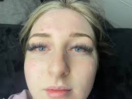 Hello Do you glue/stick shaft seals? If yes which glue do you use? Loctide  638? Thank you for your opinion. best regards and stay healthy...