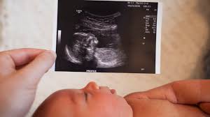 Ultrasound measurement and a blood test. What To Look For In Your Baby Boy Ultrasound