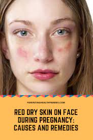 Excessive cleansing or washing of skin Pin On Chemical Pregnancy