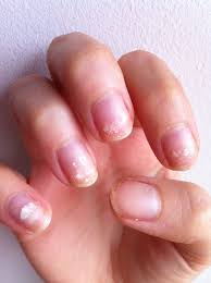Photo 80 Nails After Acrylics Gel Manicure Acrylic Nail Powder