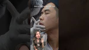 Rahasia wajah fresh dan plumpy buat para pria 🤩 #fillerformen  #mentreatment #greenfillerjakarta