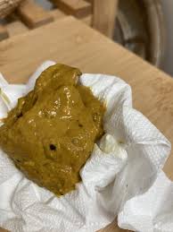 Image result for yellow stool human poop
