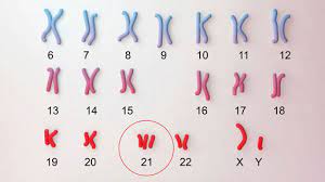 Some of these conditions are under genetic disorders can be caused by a mutation in one gene (monogenic disorder), by mutations in. Genetic Disorders