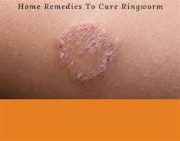 This is definitely important so that things go back to normal sooner rather than later. Does Hand Sanitizer Kill Ringworm Does Hand Sanitizer Kill Ringworm We Turned To Infectious Disease Experts To Set Things Straight