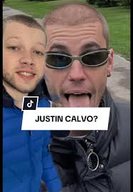 ¿Justin Bieber se está quedando calvo?
