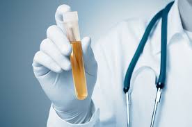Why Does Urine Smells Like Sulfur And How To Cure