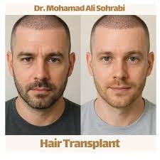 The effect of nutrition