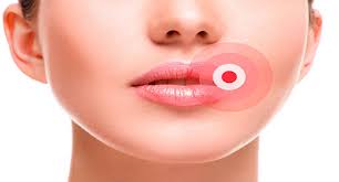 1. Проявление первых симптомов