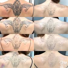 Things like ink color, concentration, age and the depth of the actual tattoo, all factor into the responsiveness of the tattoo to laser treatment. Announcing The Contest Results See Evolve Tattoo Removal S Winning Before And After Photos