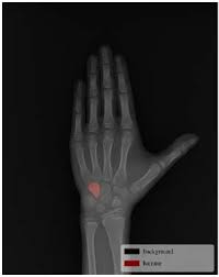 Image result for Hamate Bone