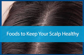 Keep a healthy diet for healthy hair. Foods To Keep Your Scalp Healthy Avail Dermatology