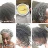 If you have an egg allergy, don't use egg yolk on your head, even as a topical treatment. 1