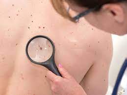 Teh warning signs of cancer can be very generic which may not help to pinpoint any particular cancer. How To Spot Cancer Early Irish Cancer Society