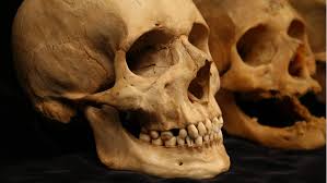 This is the lower jawbone, and is known as the inferior maxillary bone. As Our Skin Sags With Age So Do Our Bones Npr