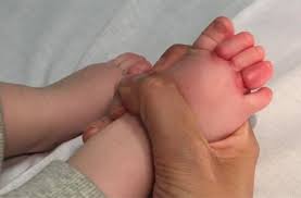 I'm convinced that babies and small children are. We Had No Idea One Little Hair Could Cause So Much Damage Mum Posts Warning About Hair Tourniquet After Baby Is Rushed To A E