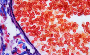 определение пола ребенка по группе крови и резус фактору Samaya Dragocennaya Krov Na Svete Bird In Flight