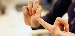 You don't have to press really hard. Capillary Refill Time In Sick Children A Clinical Guide For General Practice British Journal Of General Practice