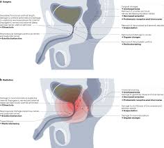 Your journey to perineum mastery starts now