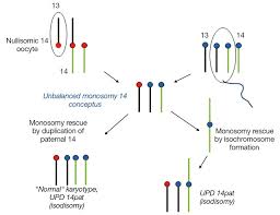 It means that two chromosomes, the structures that make up a person's dna, join together in an abnormal. Uniparental Disomy In Robertsonian Translocations Strategies For Uniparental Disomy Testing Abstract Europe Pmc