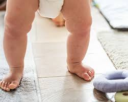 Beras putih dan beras perang berbeza khasiat dia… kita nak jaga berat badan kasi up berat takut guna beras perang berat boleh turun. Gangguan Tumbuh Kembang Bayi Usia Satu Tahun