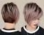 Hairstyles Female Pattern Baldness