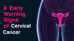 Because it can stay hidden, it's important to start getting regular cervical cancer screening at age 21, regardless of how old you were when you. 8 Early Warning Signs Of Cervical Cancer