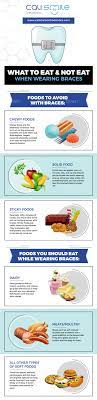 Check spelling or type a new query. Foods To Eat Or Avoid When Wearing Braces Calismile Orthodontics