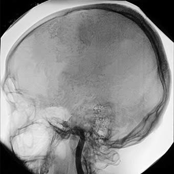 Learn About What is Brain Death - Donate Life California