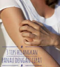 Lakukan cara ini secara teratur 2 kali dalam sehari agar panu yang anda derita segera sembuh. 3 Tips Hilangkan Panau Dengan Cepat Permatahatibidadariku