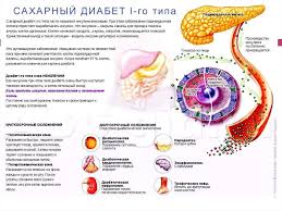 Saharnyj Diabet U Ginekologicheskih Bolnyh Prezentaciya Onlajn
