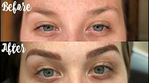 Check spelling or type a new query. Microblading Before And After 10 Day Healing Process Youtube
