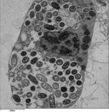 See more of legionella on facebook. Legionella Pneumophila Wikipedia