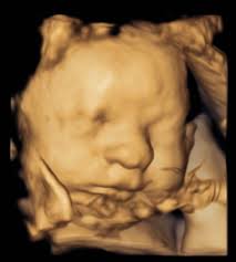 Hey y'all I just got back from the hospital. Turns out I was in pre term  labor. When I got there I was already 2cm dilated, 80% effaced. I'm 32  weeks today.