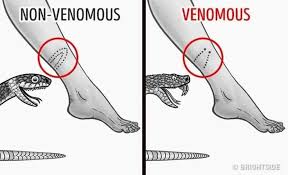 How to differentiate venomous and non-venomous snake bite? Have ...