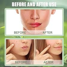 Image result for Grevea