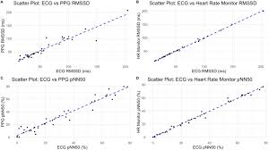 Image result for Electrocardiogram Validity