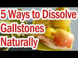 How To Dissolve Gallstones Naturally 5 Ways Youtube Gallstones Gallbladder Stones Gallbladder Attack