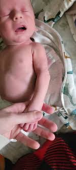 Danielle and Derek Kraus of Park Rapids, Minn., had no idea their son Henry  would be diagnosed with neonatal Marfan syndrome, a rare and serious  condition.