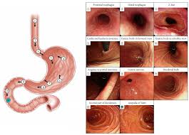 Quality indicators in esophagogastroduodenoscopy
