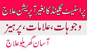 How To Treat Enlarge Prostate Gland With Out Operation In Urdu And Hindi Youtube Enlarged Prostate Gland Prostate