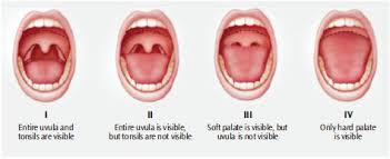 These patients merit special attention from both the sleep physician and the anaesthetist. Sleep Apnea Screening In The Dental Office Dimensions Of Dental Hygiene
