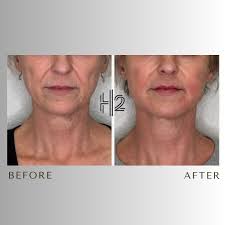 Dr. Hanby's Healthy 100