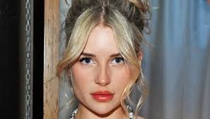 Lottie Moss, lultima follia: cosa è successo al suo viso